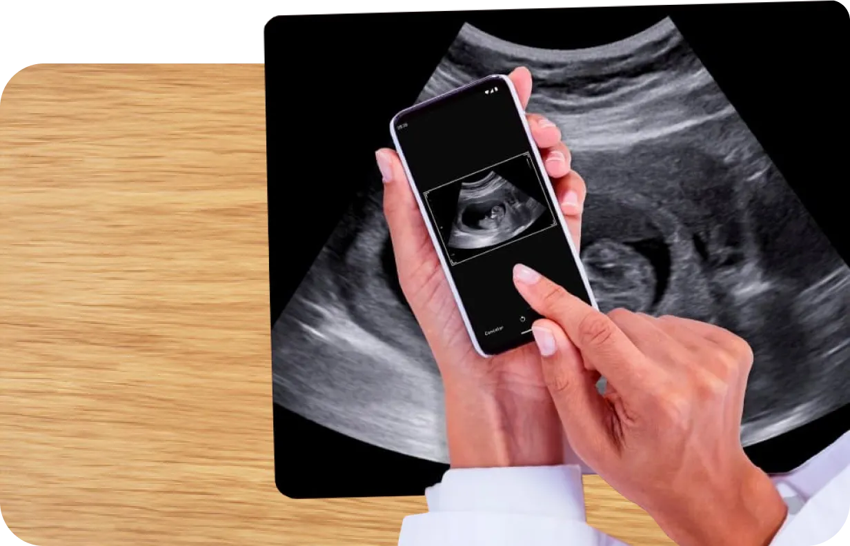 Uma mão com celular digitalizando uma radiografia