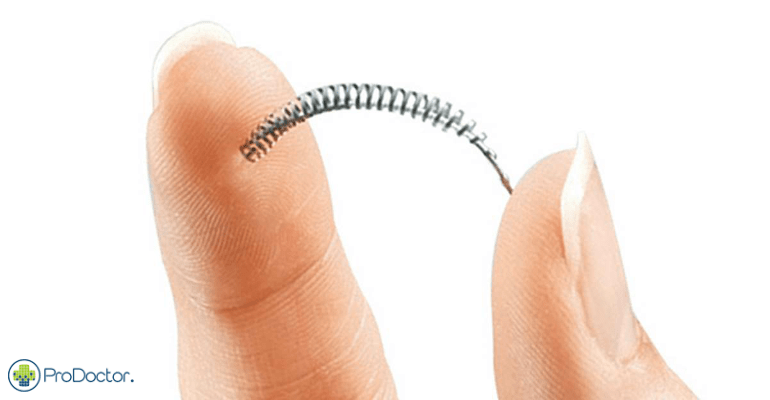 Determinada a suspensão do produto Sistema Essure
